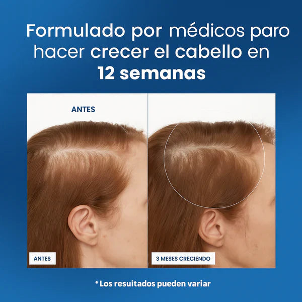 Roll-On de Crecimiento Capilar™ 10ml