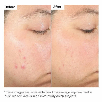 the ordinary salicylic acid