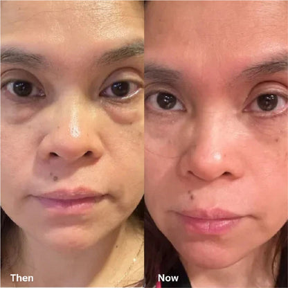 Dr. Melaxin – Bálsamo Contorno de Ojos 10ml